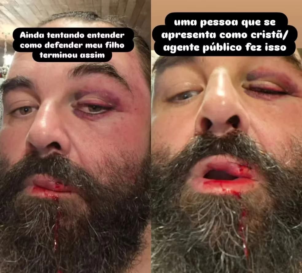Guarda Municipal agride pai após denúncia de som alto de igreja em Balneário Camboriú